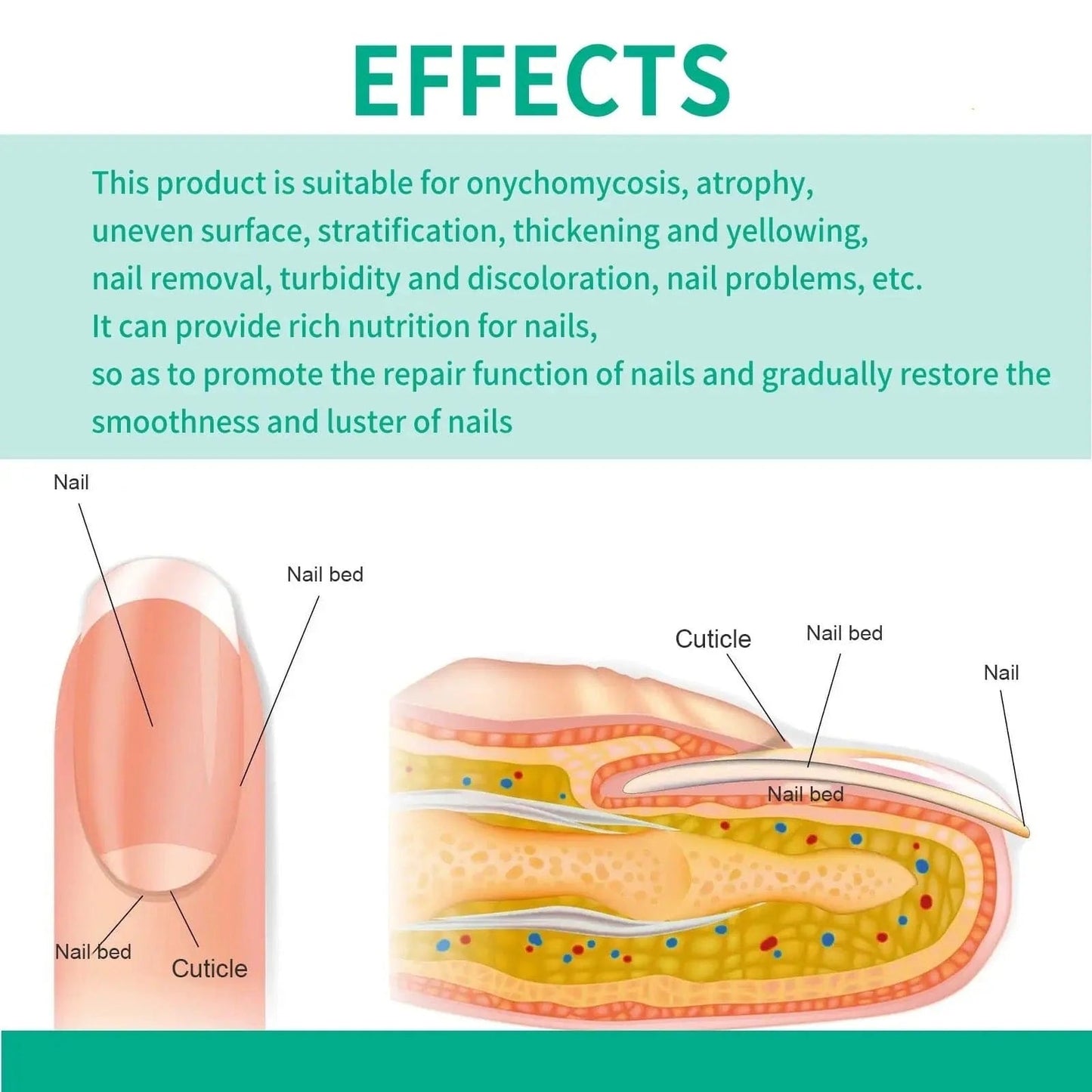 Nail Fungus Treatments Serum for healthy growth