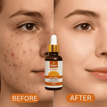 ORGANIC LAB | FACE SERUM 30ML (VITAMIN C)